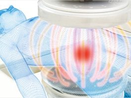 熱に弱い癌細胞を42度超で加熱、死滅や増殖抑制に導く