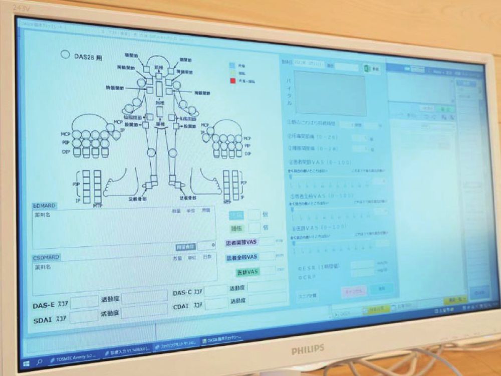 関節を丁寧に触診し痛みや腫れの状態を記録します