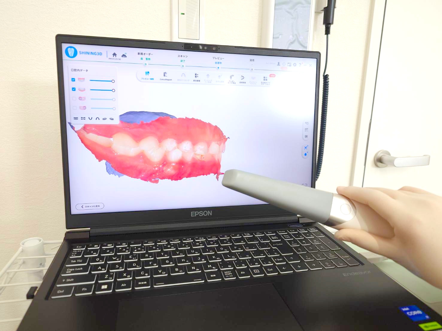 3Dスキャナーを用いた型取りは患者目線で歯の状況を目で見てわかりやすいのも特長です